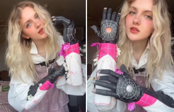 Tilly Lockey modeling the spider girl arm covers for the Hero Pro wireless bionic hands.