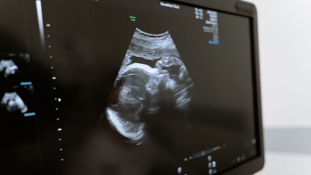 Ultrasound Smile